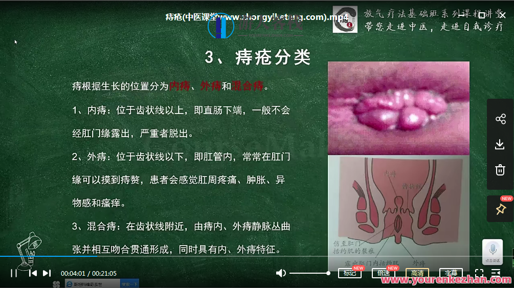 放气疗法全能班 带状疱疹